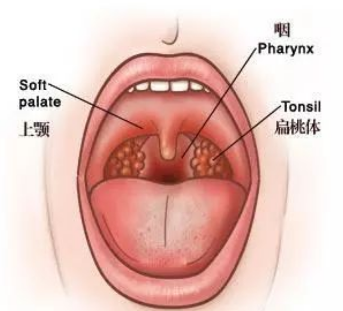 男子竟咳出了自己的扁桃体!这些信号他都忽视了
