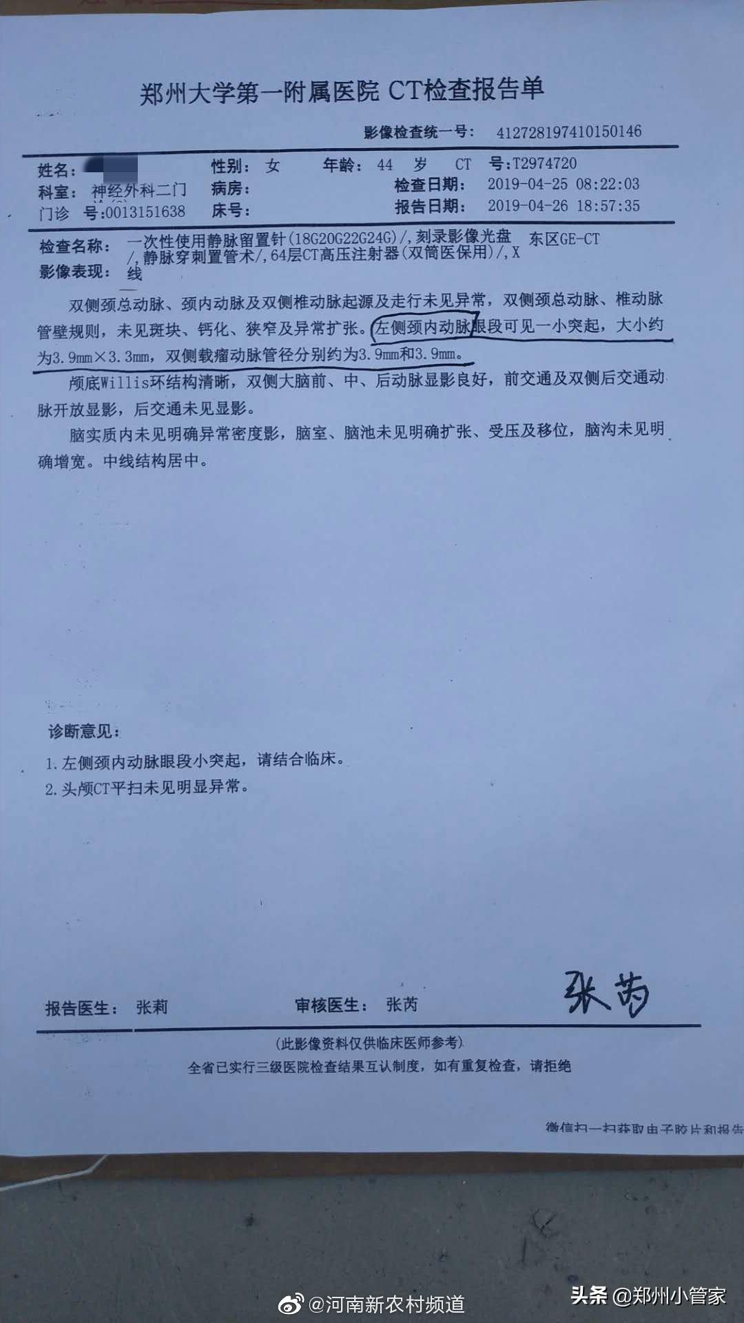 郑州一医院ct检查闹"乌龙" 16天花6万治疗无病右脑
