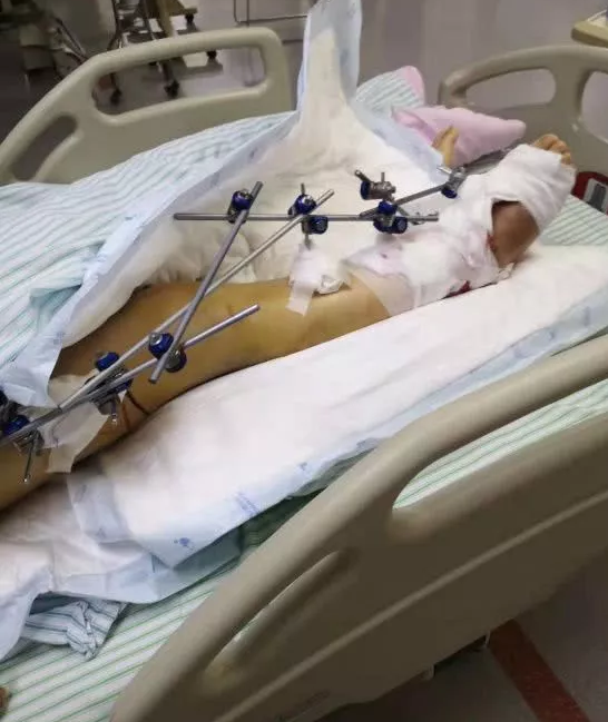 焦作一公务员出差时跳楼身亡无辜女子被砸重伤索赔难