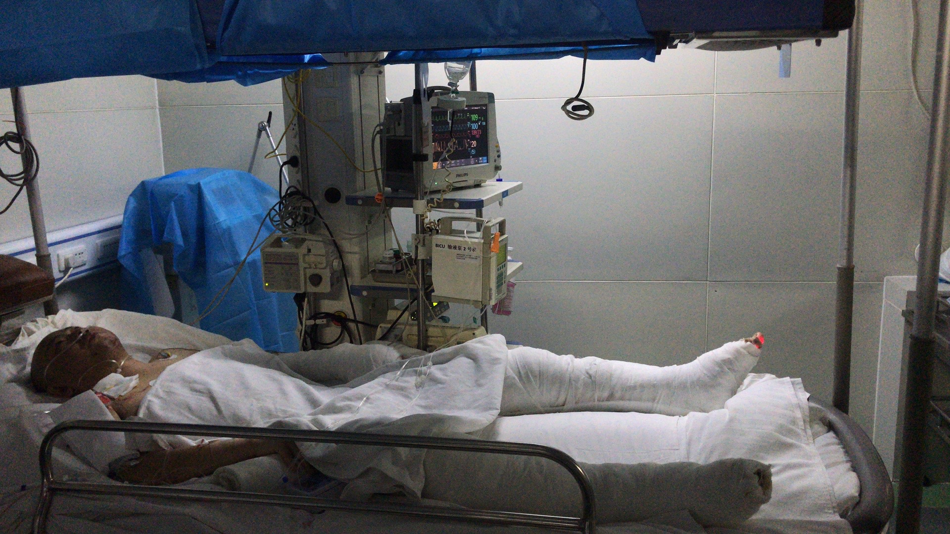 带领千名残疾人"圆梦"的他意外烧伤 请救救这位"残梦"英雄!